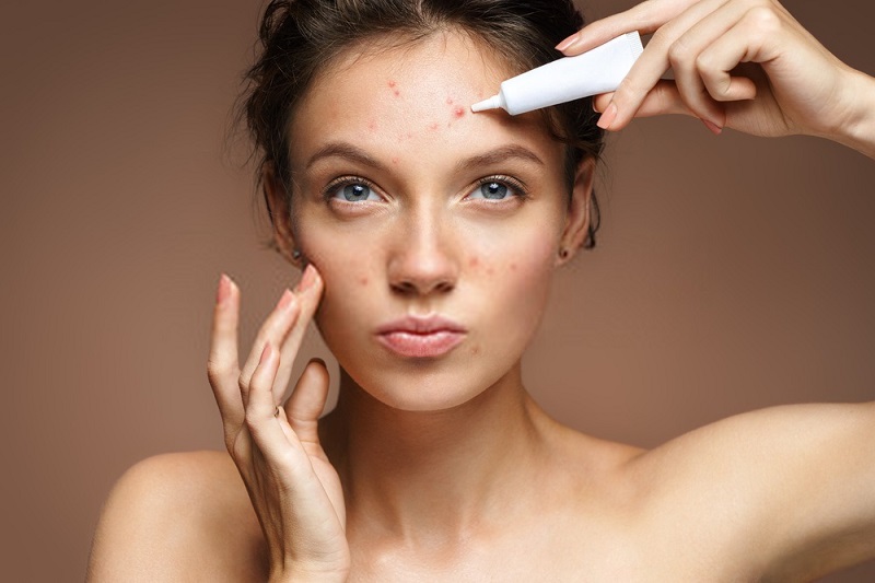 Beauty-Benefits-Of-Coconut-Oil-Coconut-oil-against-acne-and-skin-impurities