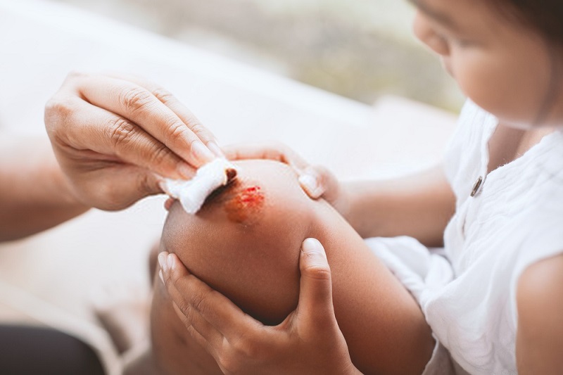 Beauty-Benefits-Of-Coconut-Oil-Coconut-oil-for-wound-healing