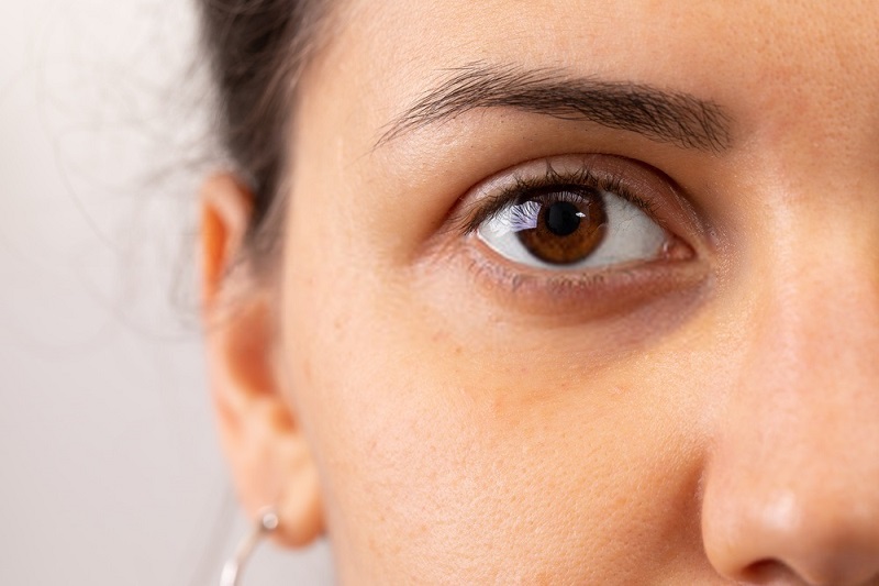 Beauty-Benefits-Of-Coconut-Oil-Coconut-oil-against-dark-circles